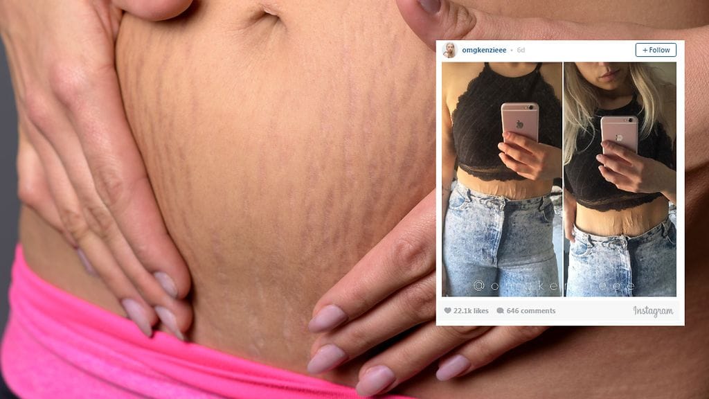 Kuvituskuva Shutterstock, toisen kuvan lähde Instagram.