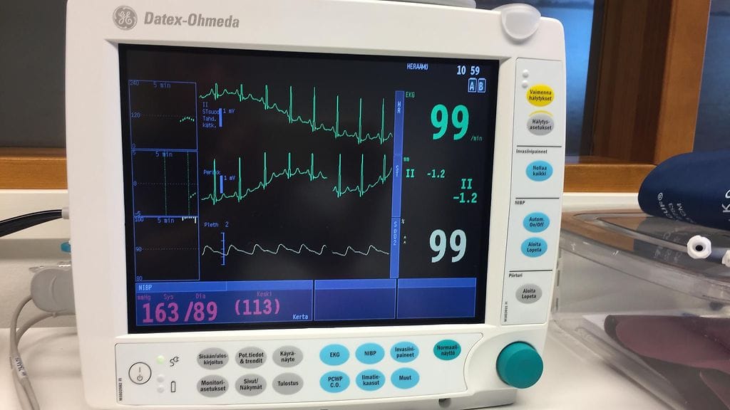 Sähköhoito EKG