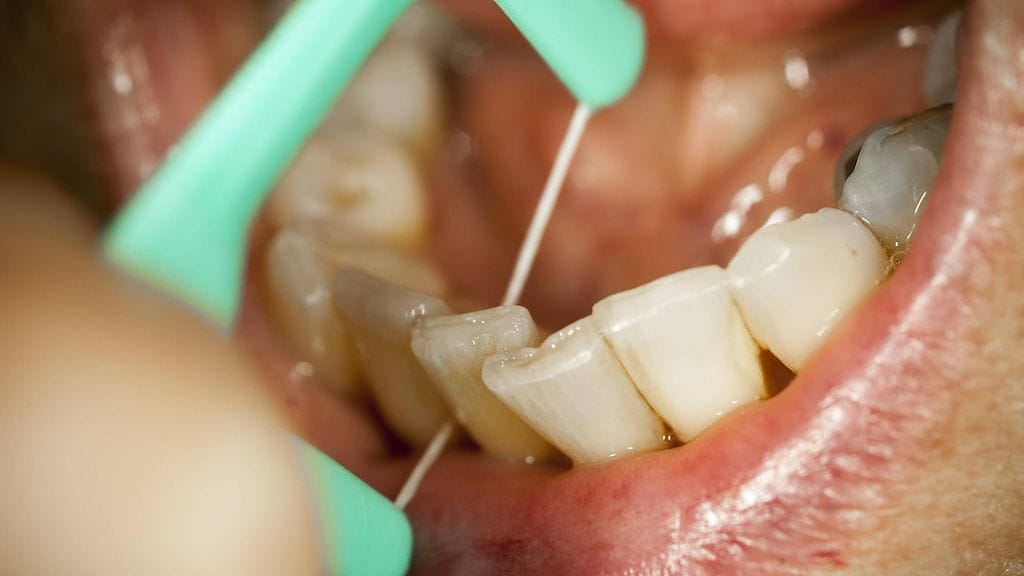 Hoitamaton suu on riski yleisterveydelle.