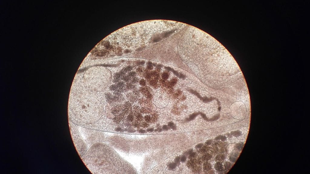 Särjestä löytyneitä maksamatoja mikroskoopissa. Kuva: Barbara Moroni/Evira.