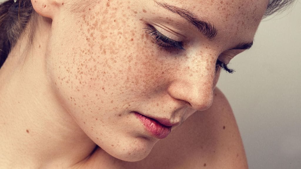 Pisamat ja kesakot menevät helposti sekaisin. Tiedätkö sinä eron?