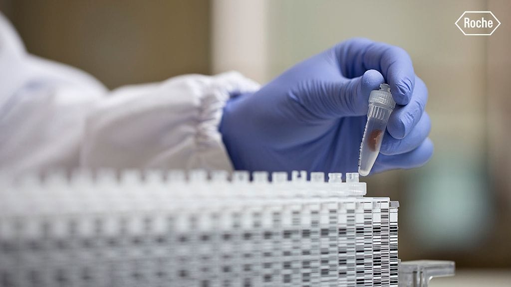 Rochen strategiana on kehittää uusia lääkkeitä sairauksiin, joihin on ennestään vain vähän tai ei lainkaan toimivia hoitomuotoja.