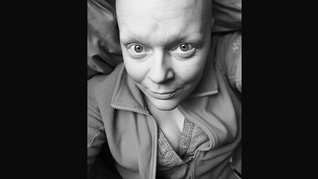 Kirjailija Minttu Vettenterä toivoo tietoisuuden alopecian ympärillä lisääntyvän.