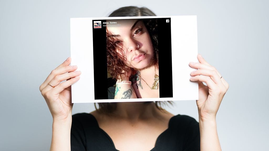 Nainen päätti tulla harvinaisen sairautensa kanssa esille.