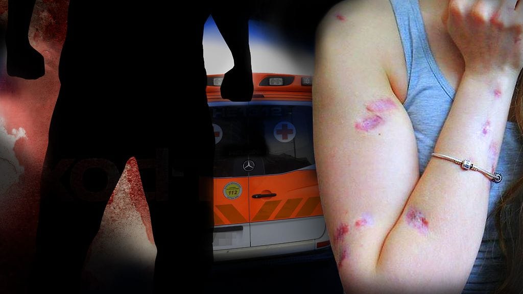 Saijan vartaloon on jäänyt lukuisia arpia veitseniskuista. Hänellä on myös elinikäinen aivovamma hyökkäyksen jäljiltä. Henkilöiden nimet on muutettu jutussa.