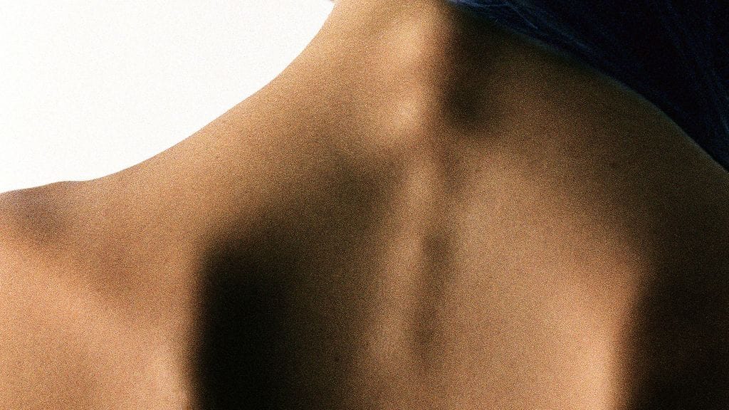 Anoreksia on hengenvaarallinen sairaus.