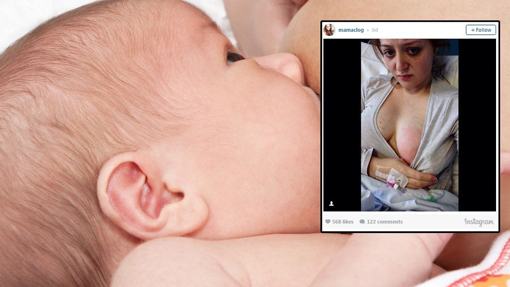 Kuvituskuva Shutterstock, toisen kuvan lähde Instagram.