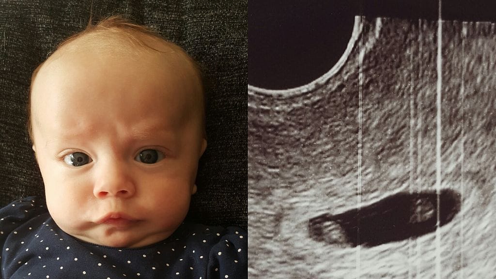 Miia Honkaniemen esikoispoika saa loppuvuodesta kaksi pientä sisarusta.