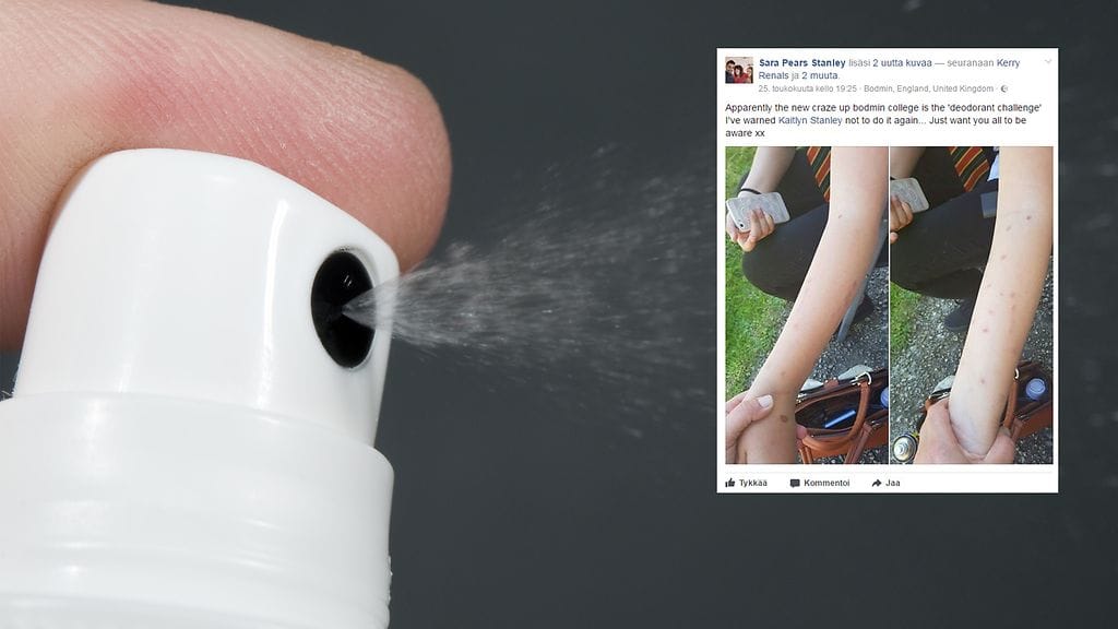 Suurina määrinä spray-deodorantti voi aiheuttaa vakaviakin ihovaurioita.