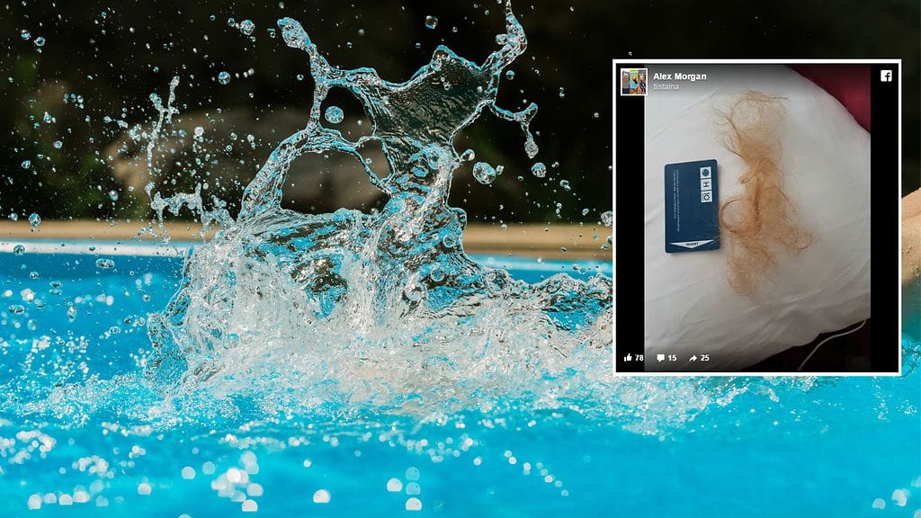 Tyttö menetti kammottavassa onnettomuudessa tukon hiuksiaan.