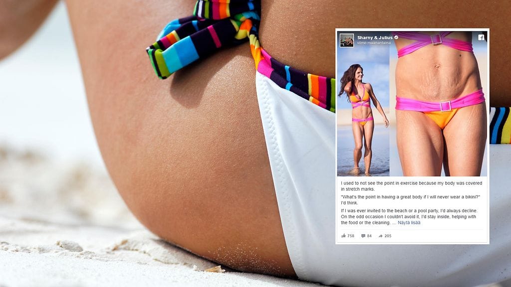 Nainen sai unelmiensa bikinivartalon vain yhdellä muutoksella.