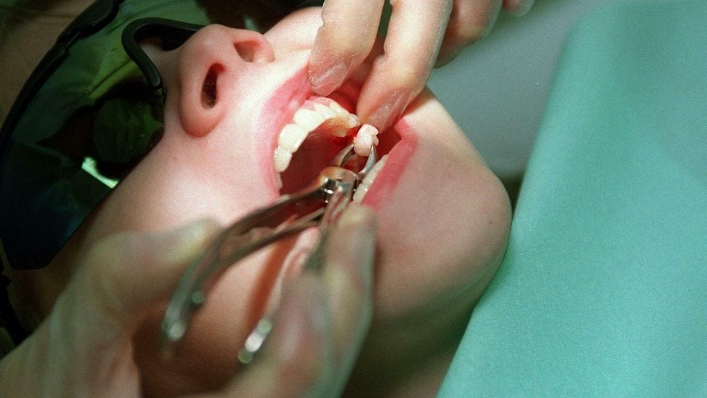 "Vain puudutteen ruiskuttaminen pistää hieman", kertoo hammaslääkäri viisaudenhampaan poistosta. Kuvituskuva.