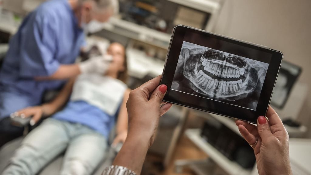 Vajaat kymmenen prosenttia viisaudenhampaan poistoon menevistä potilaista saa hermovaurion. Prosentilla vaurio jää pysyväksi. Kuvituskuva.