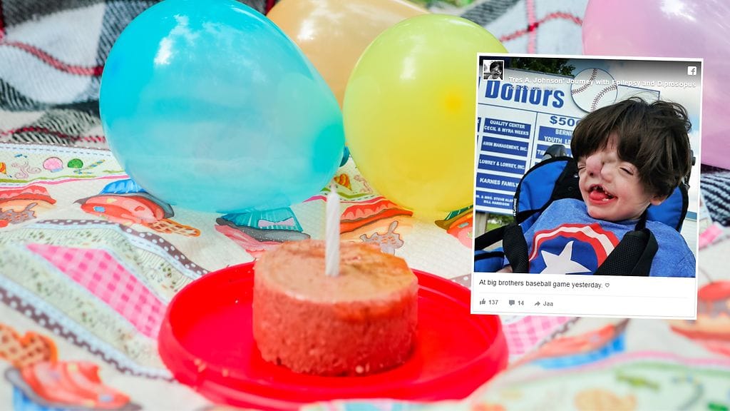 Kaksikasvoisena syntyneen pojan elämä on ollut tähän asti pitkä selviytymiskamppailu.