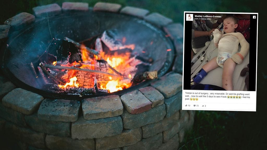 Vanhemmat oppivat kantapään kautta, että nuotio voi olla kuuma vielä pitkään sammumisen jälkeenkin.