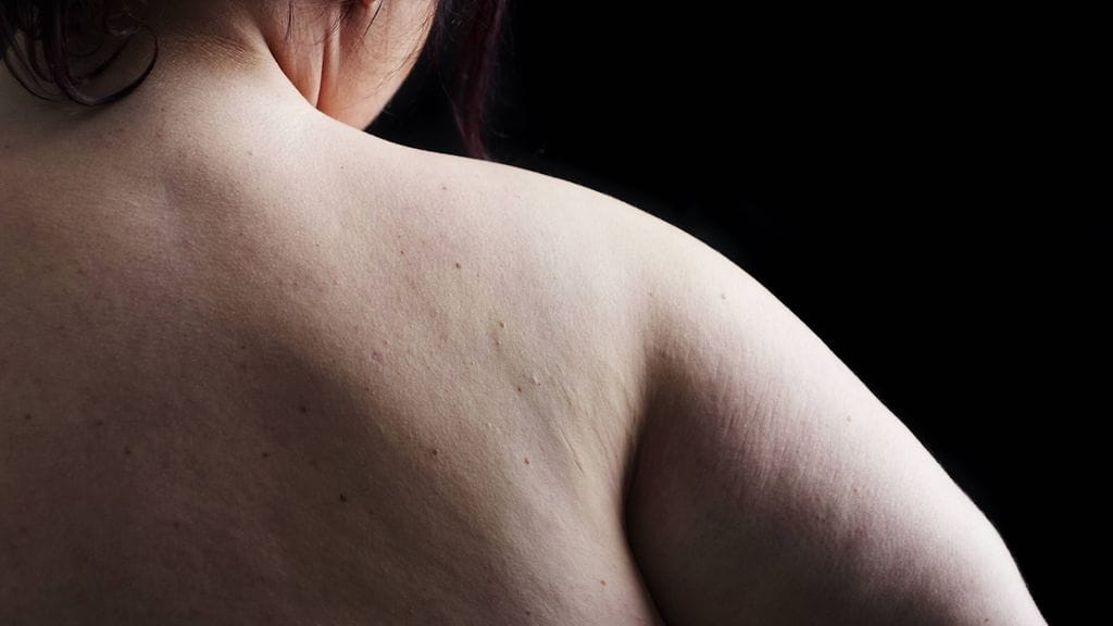 Yli kahdella miljardilla ihmisellä on liikakiloja.