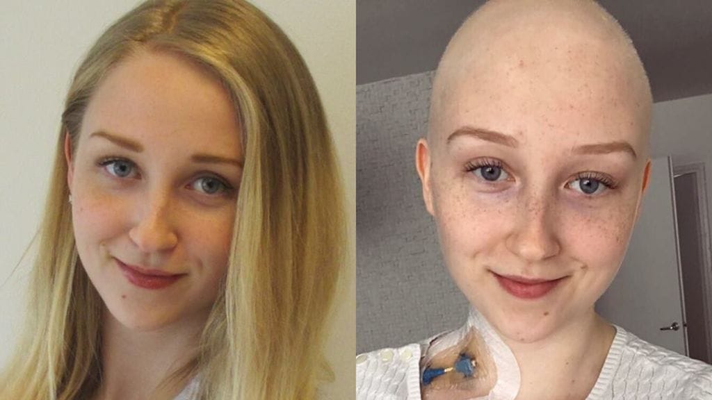 Vivian Salo saa kantasolusiirron syyskuussa.