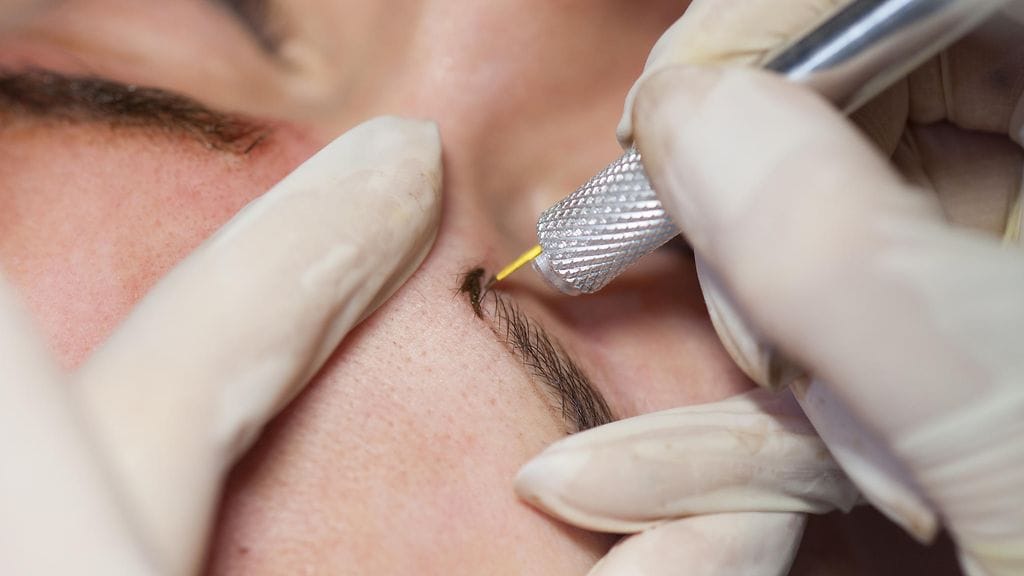 Värjäyksen suorittanut klinikka ei usko itse menetelmän olleen syyllinen naisen vakavaan reaktioon.