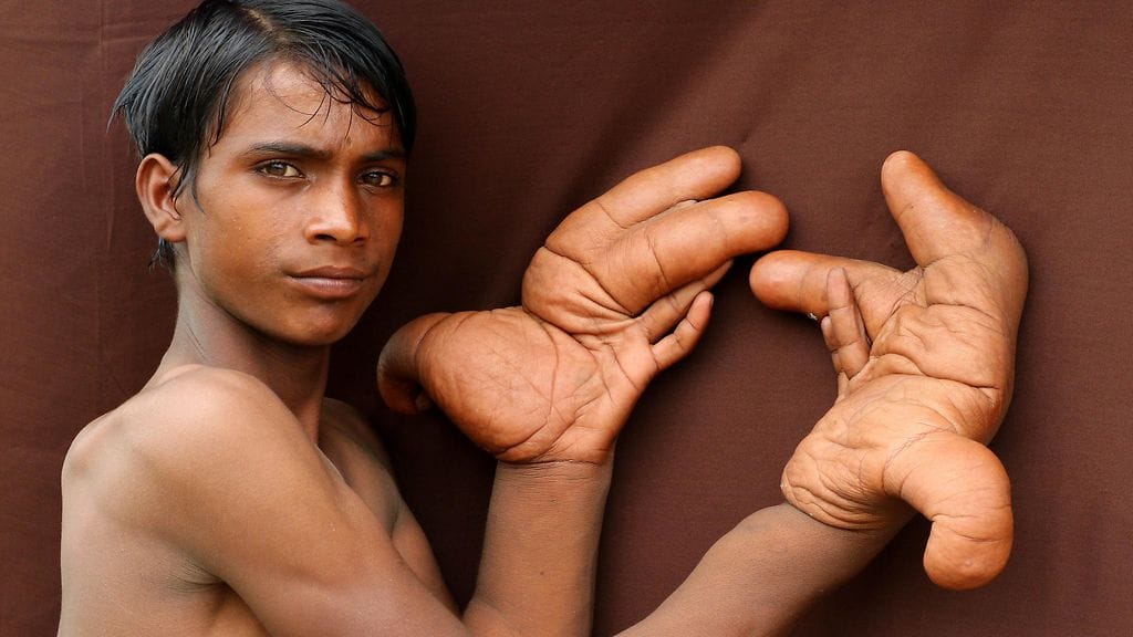 Tarik esittelee käsiään kuvaajan pyynnöstä.