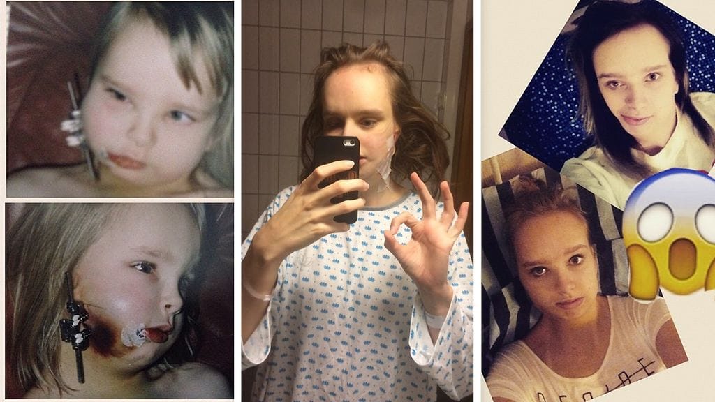 "Hankala sanoa, milloin olen valmis", toteaa kaustislainen 20-vuotias Jutta Kangas, jonka sairastama harvinainen oireyhtymä on vaatinut lukuisia korjausleikkauksia.