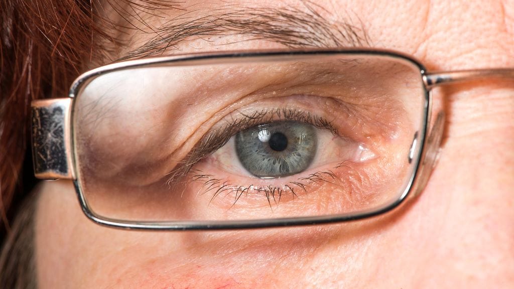 Huononäköisten toimintakyky heikentyi tutkimuksessa noin kaksi kertaa todennäköisemmin kuin osallistujien, jotka kokivat näkökykynsä hyväksi.