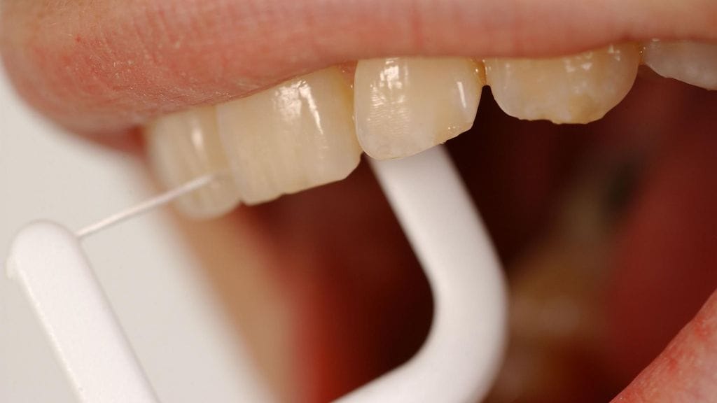 Hammaslankaa tulisi muistaa käyttää päivittäin.