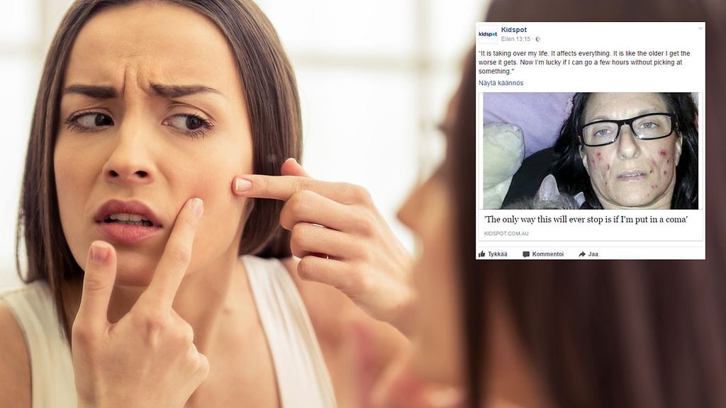 Kuvituskuva Shutterstock, toisen kuvan lähde Facebook.