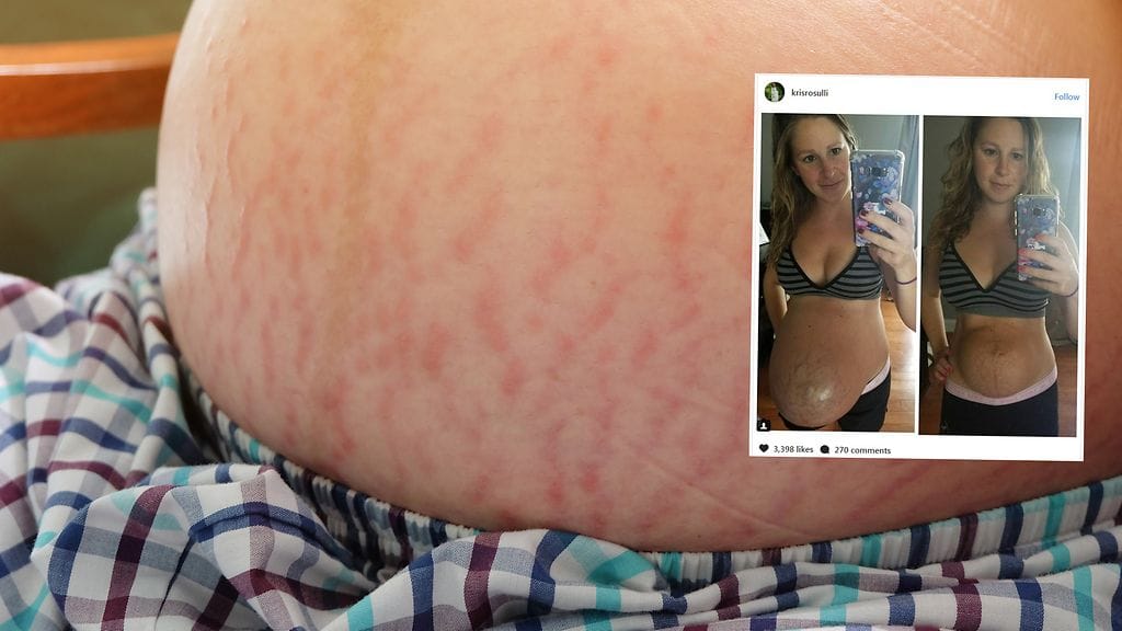 Kahden lapsen äiti huomasi, että jokainen raskaus on erilainen.