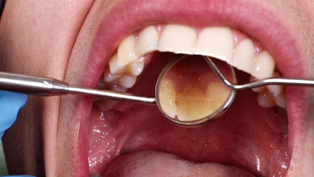 Iensairaudet ovat huomattava terveysongelma Suomessa. Kuvituskuva.