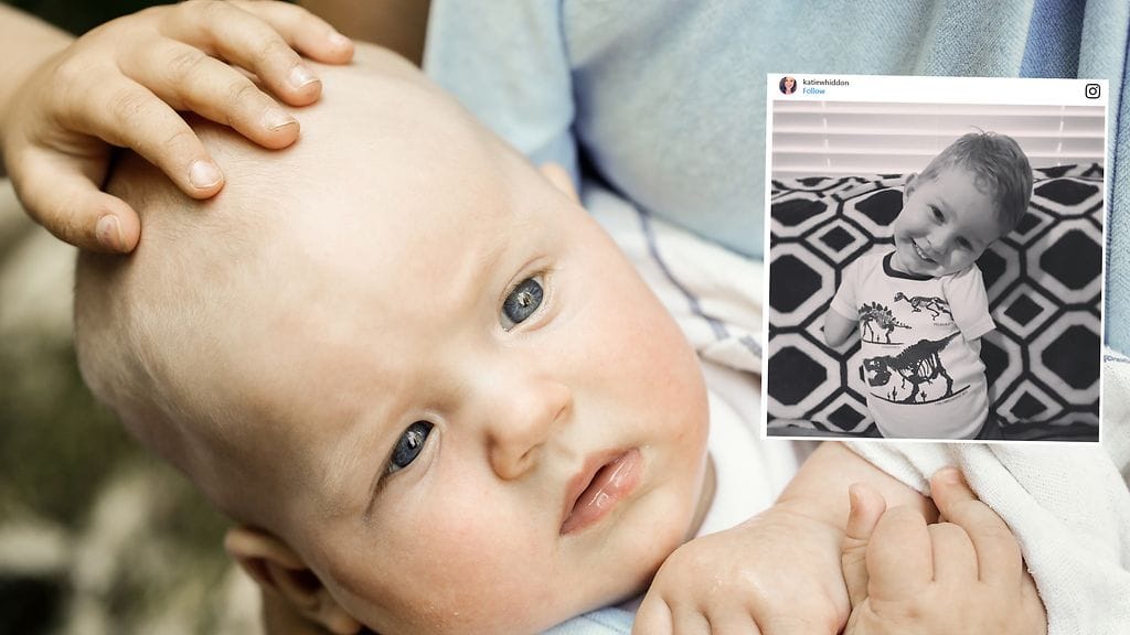 Pian neljävuotta täyttävä Camden ei ole antanut vamman estää häntä elämästä tavallista pikkupojan elämää.