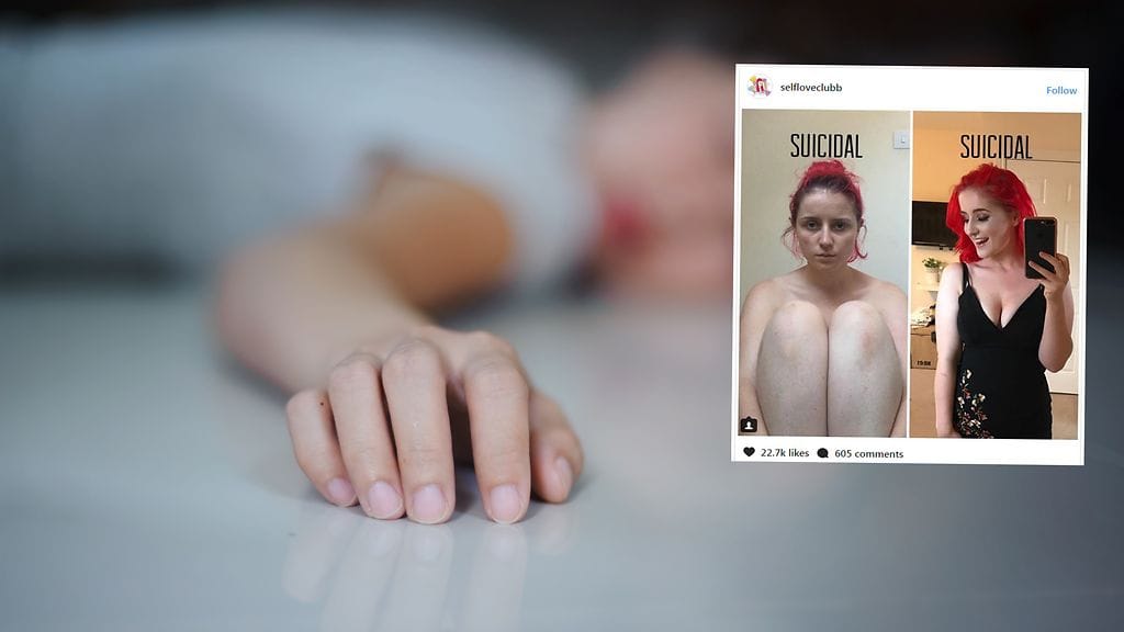 Itsetuhoiset ajatukset eivät heijastu ulkonäköön, nainen muistuttaa.