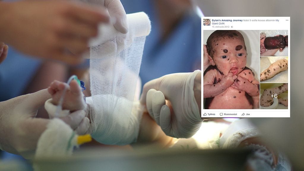 Pikkupoika on joutunut pienen elämänsä aikana käymään läpi kymmeniä leikkauksia.