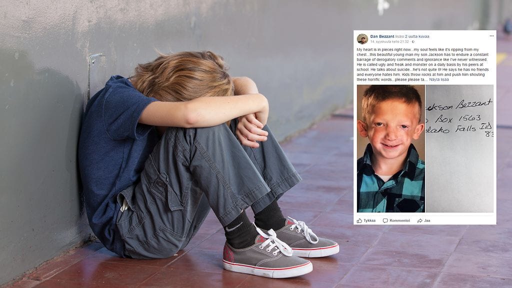 Isän mukaan Jackson ei välttämättä näytä samalta kuin muut lapset, mutta hänellä on iso sydän.