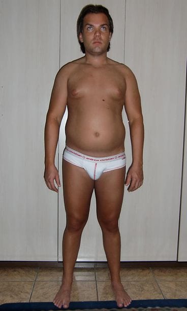 Rodrigo Alves ennen leikkausta