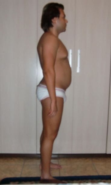 Rodrigo Alves ennen leikkausta 2