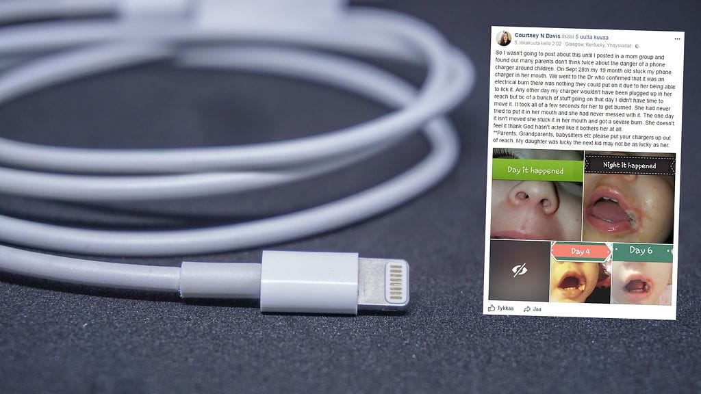 Puolitoistavuotiaan tytön suussa näkyy jälkiä tapahtuneesta vielä viikko tapahtuneen jälkeen.