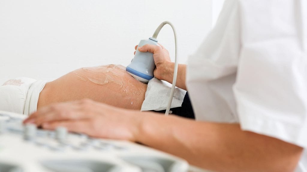 Ultraäänitutkimus paljasti hengenvaarallisen tilan. Kuvituskuva.