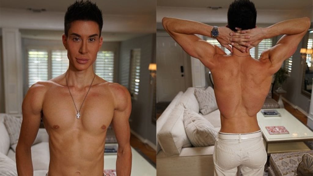 Justin Jedlica on käyttänyt kauneusleikkauksiin lähes puoli miljoonaa euroa.