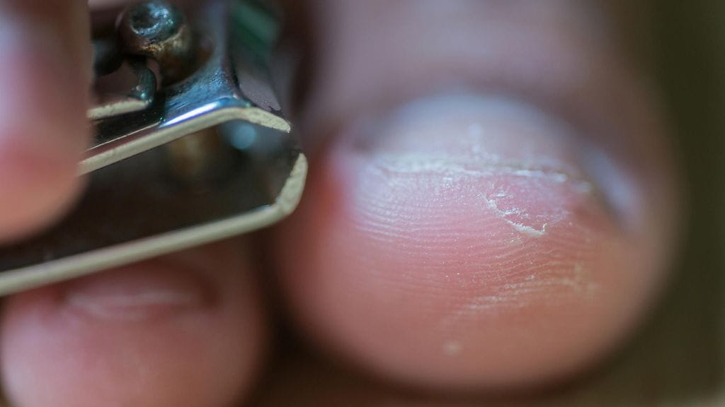 varpaankynsi, leikkuri