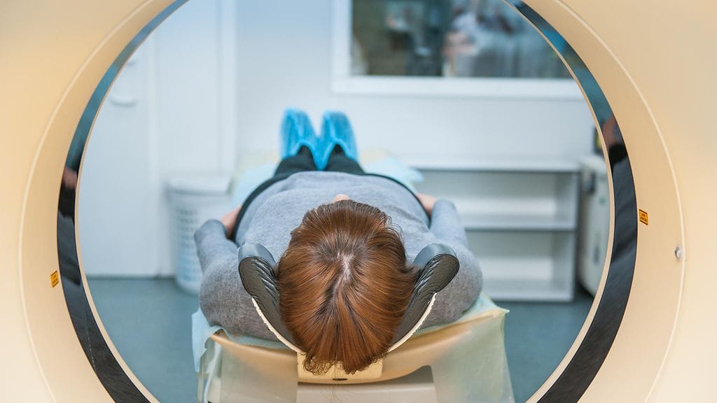 Aivokasvaimen diagnosoinnissa käytetään magneettikuvausta. Kuvituskuva.