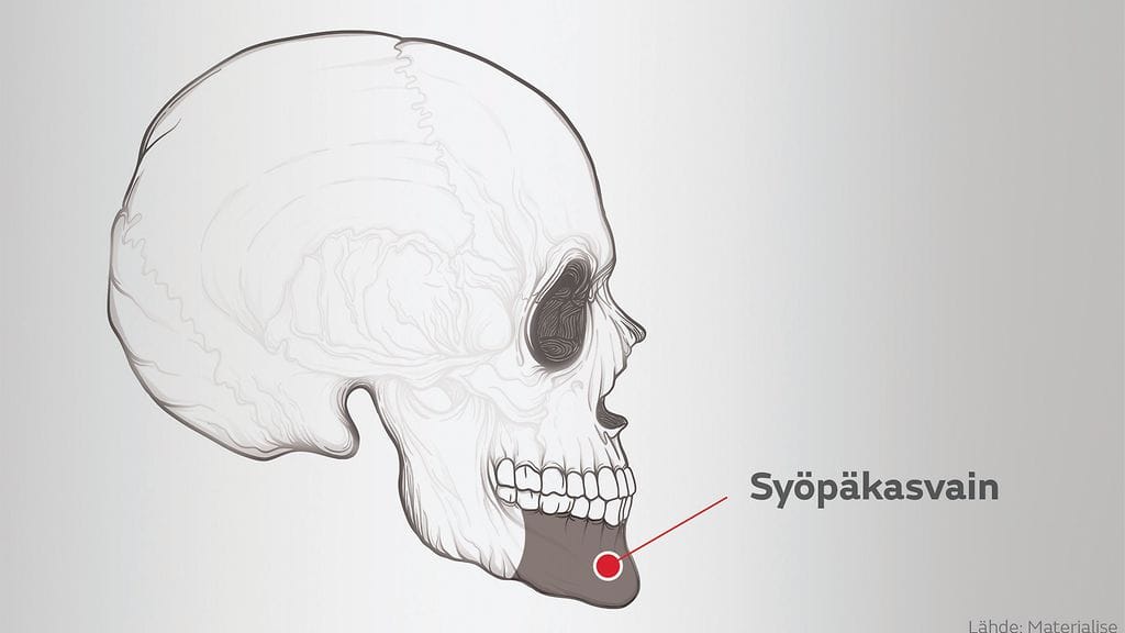 luusuunnittelukuva_leuka_1