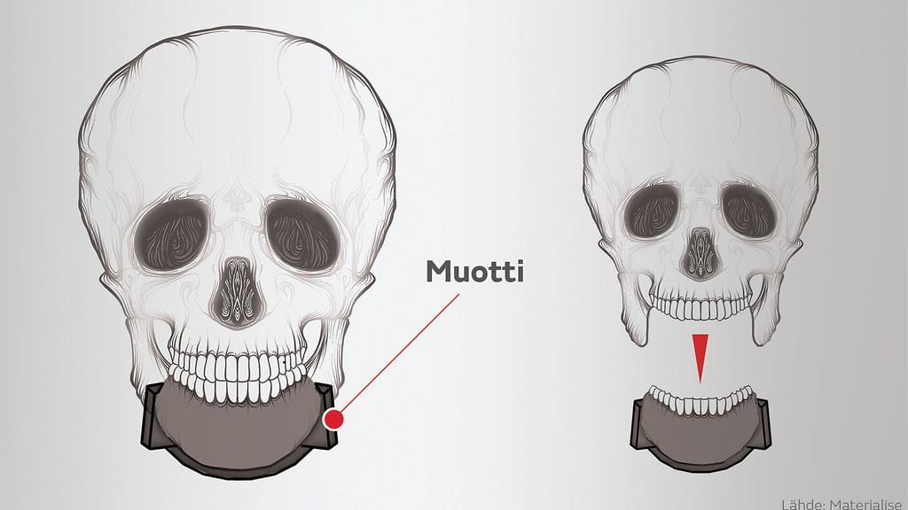 luusuunnittelukuva_leuka_2