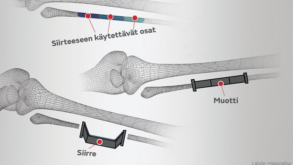 luusuunnittelukuva_leuka_3