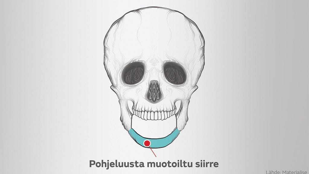 luusuunnittelukuva_leuka_4