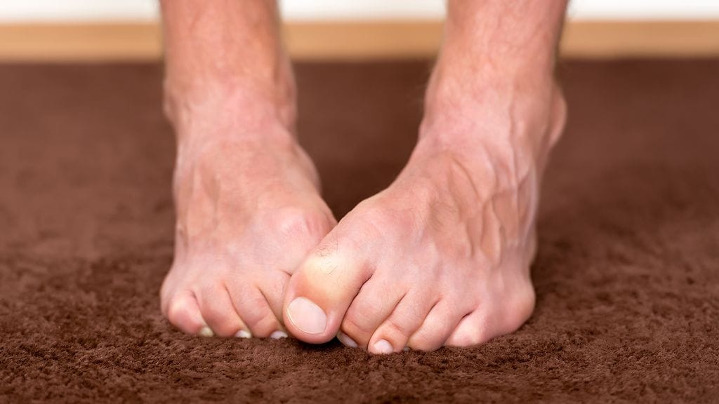 Lämpimien sukkien vetäminen jalkaan on tehokkain keino hoitaa palelevia jalkoja.