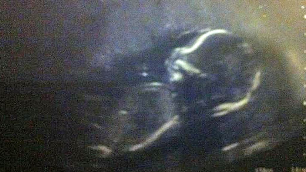 11-vuotias tyttö ei tiennyt olevansa raskaana ennen synnytystä. Kuvituskuva.