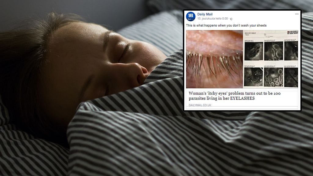 Kuinka usein lakanat tulisi pestä? Eräs nainen jätti pesuvälin niin pitkäksi, että sai silmiinsä punkkeja.