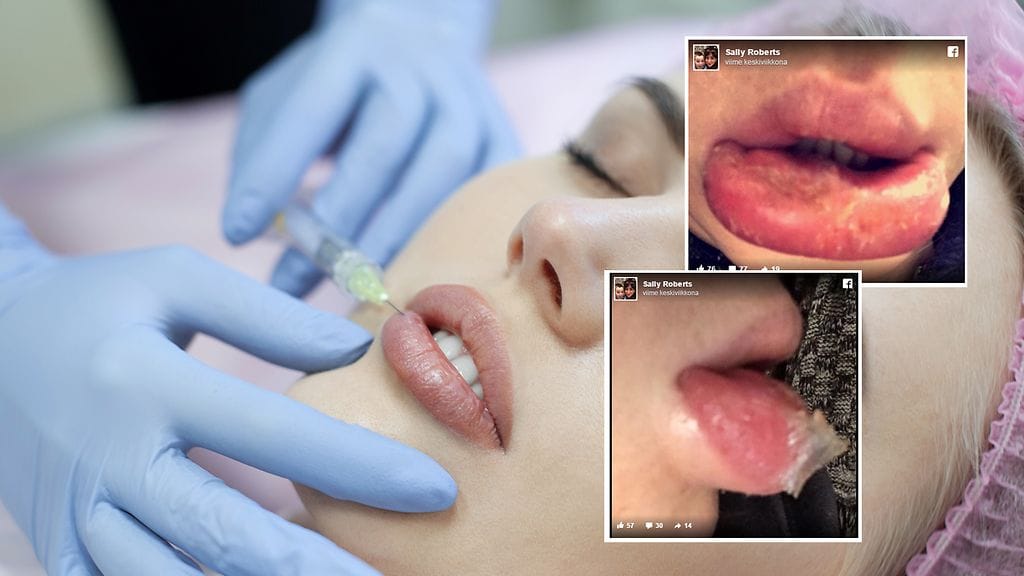 Kuvan lähde Shutterstock, kuvakaappaukset Facebook.