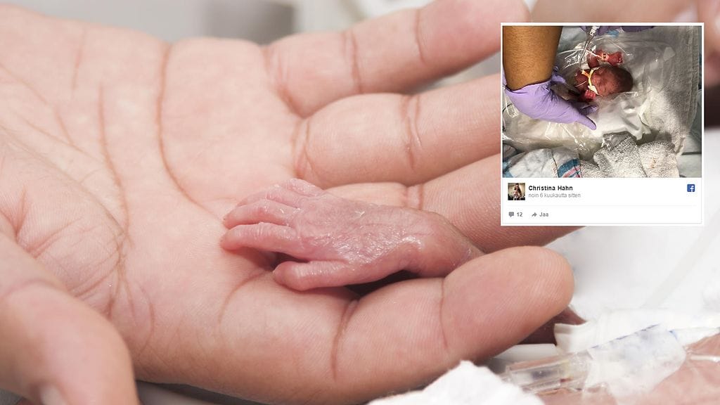 Vanhemmat kuvailevat neljä kuukautta ennen laskettua aikaa syntynyttä lastaan ihmeeksi.