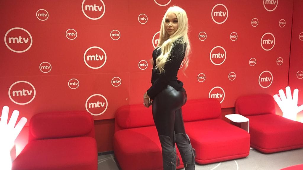 Crista Jaatinen pelkää, miltä edessä odottavan leikkauksen lopputulos tulee näyttämään.